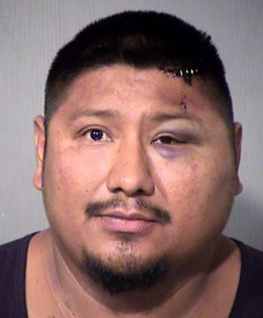 garcia county assaulting accused sexually glendale neighbor man doctors maricopa gash mugshot staples close head source used his arizona sheriff